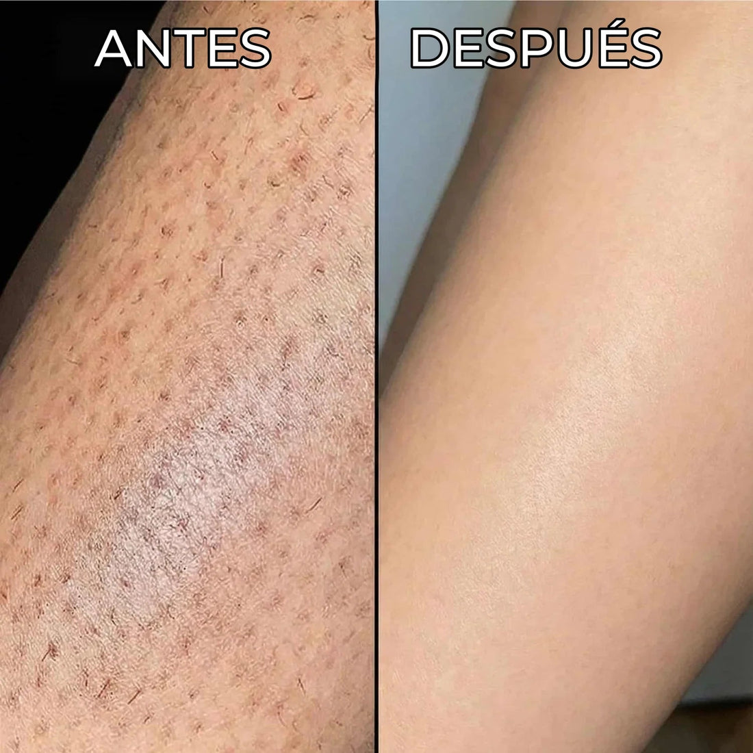 Inhibidor vegetal del vello Nesolia