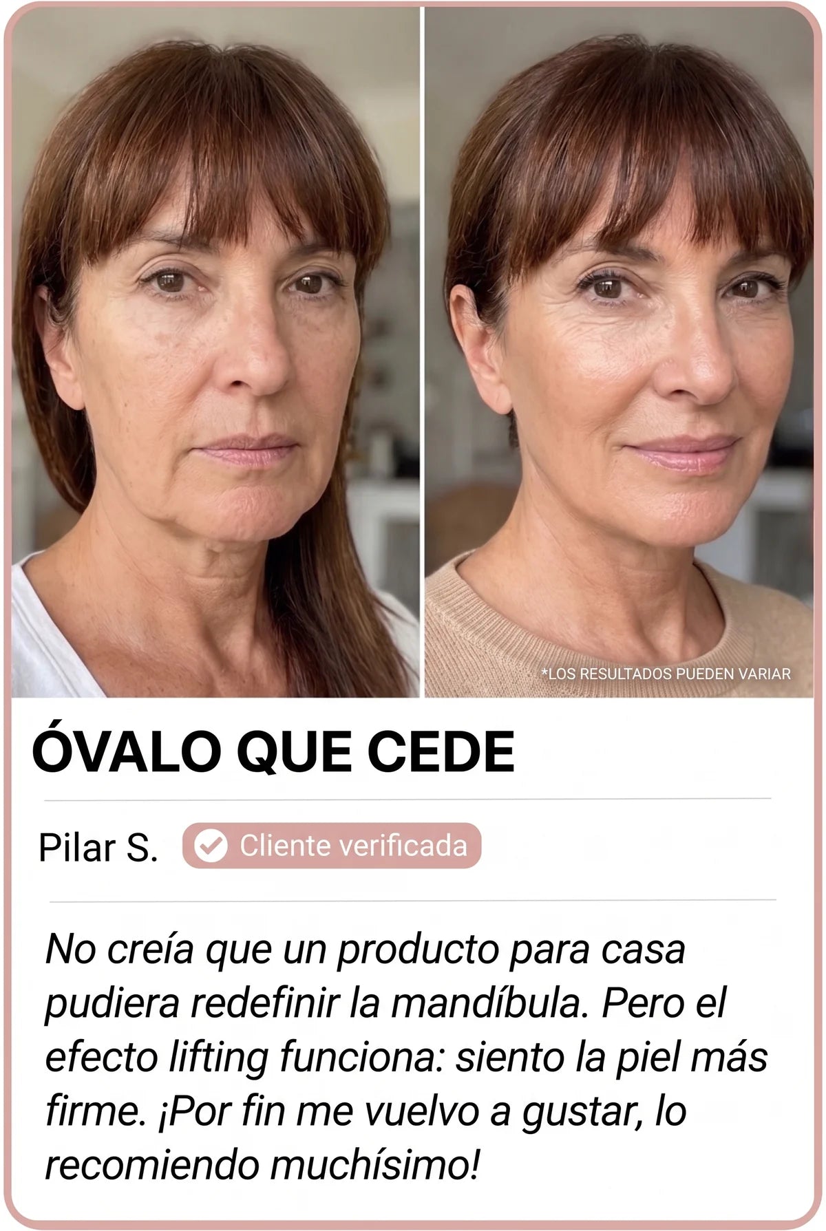 Transformación de clienta Nesolia 3