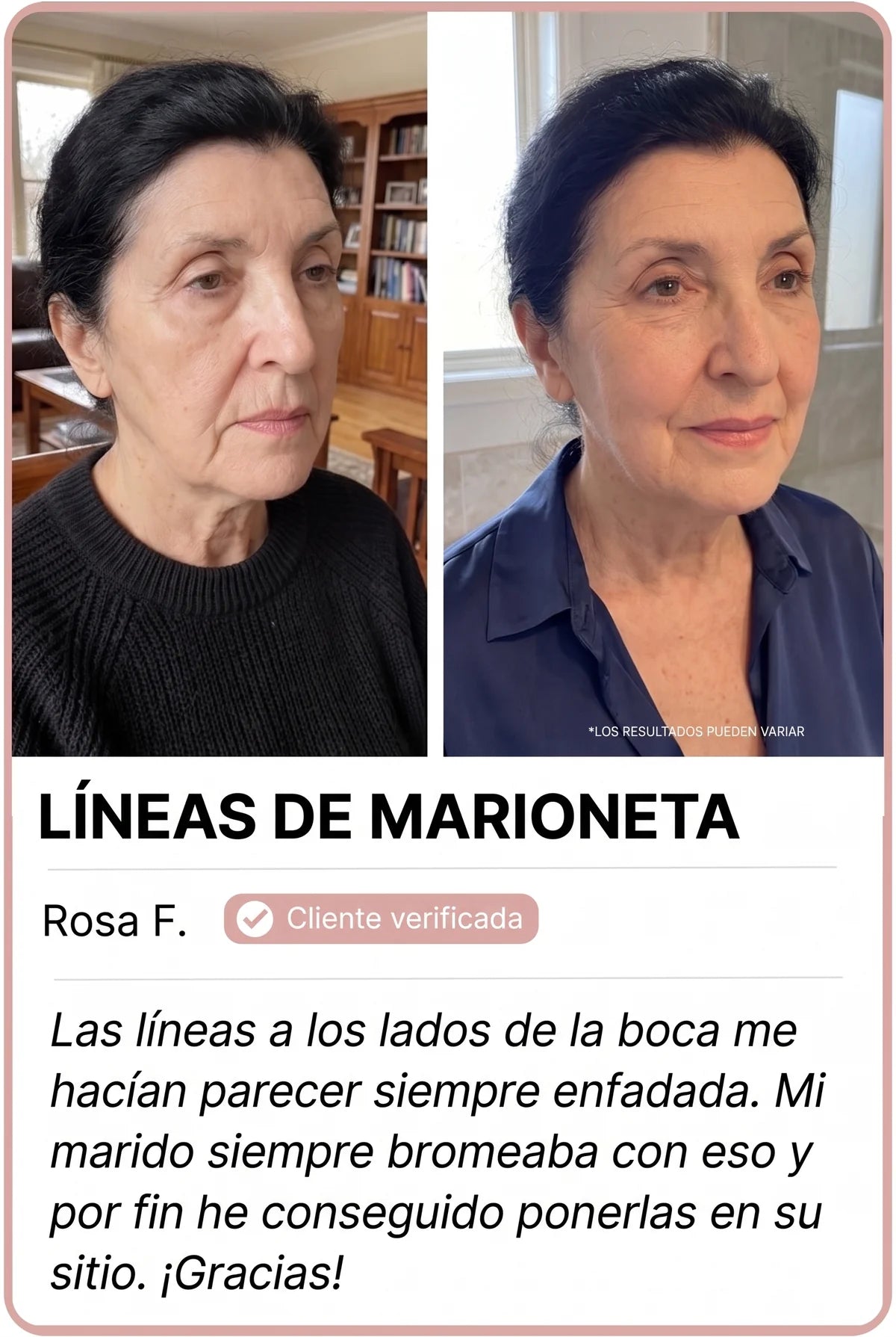 Transformación de clienta Nesolia 5