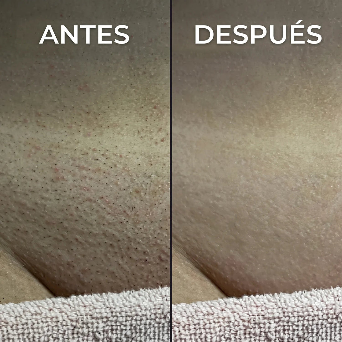 Inhibidor vegetal del vello Nesolia
