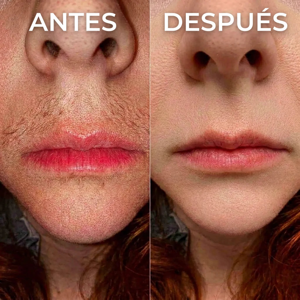 Inhibidor vegetal del vello Nesolia