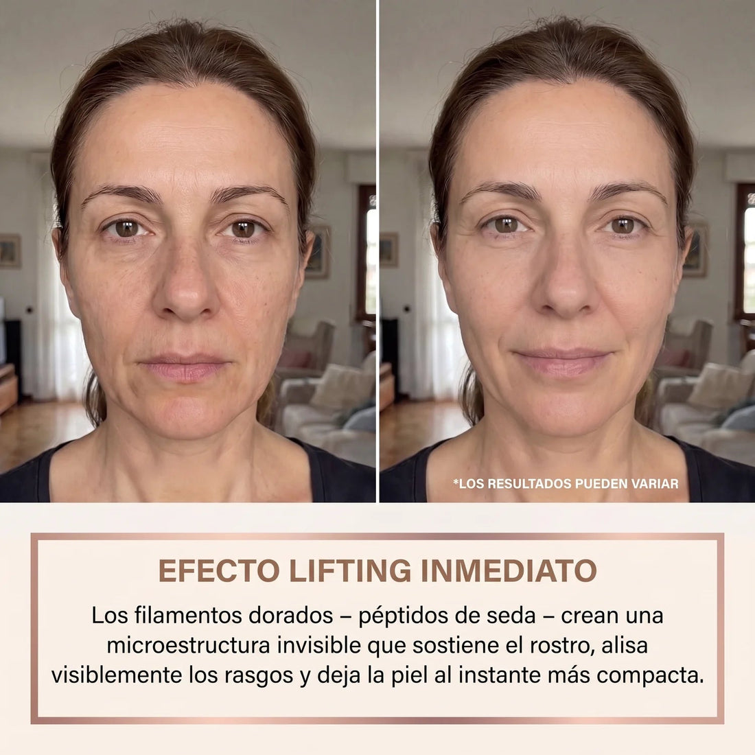 Antes y después efecto lifting