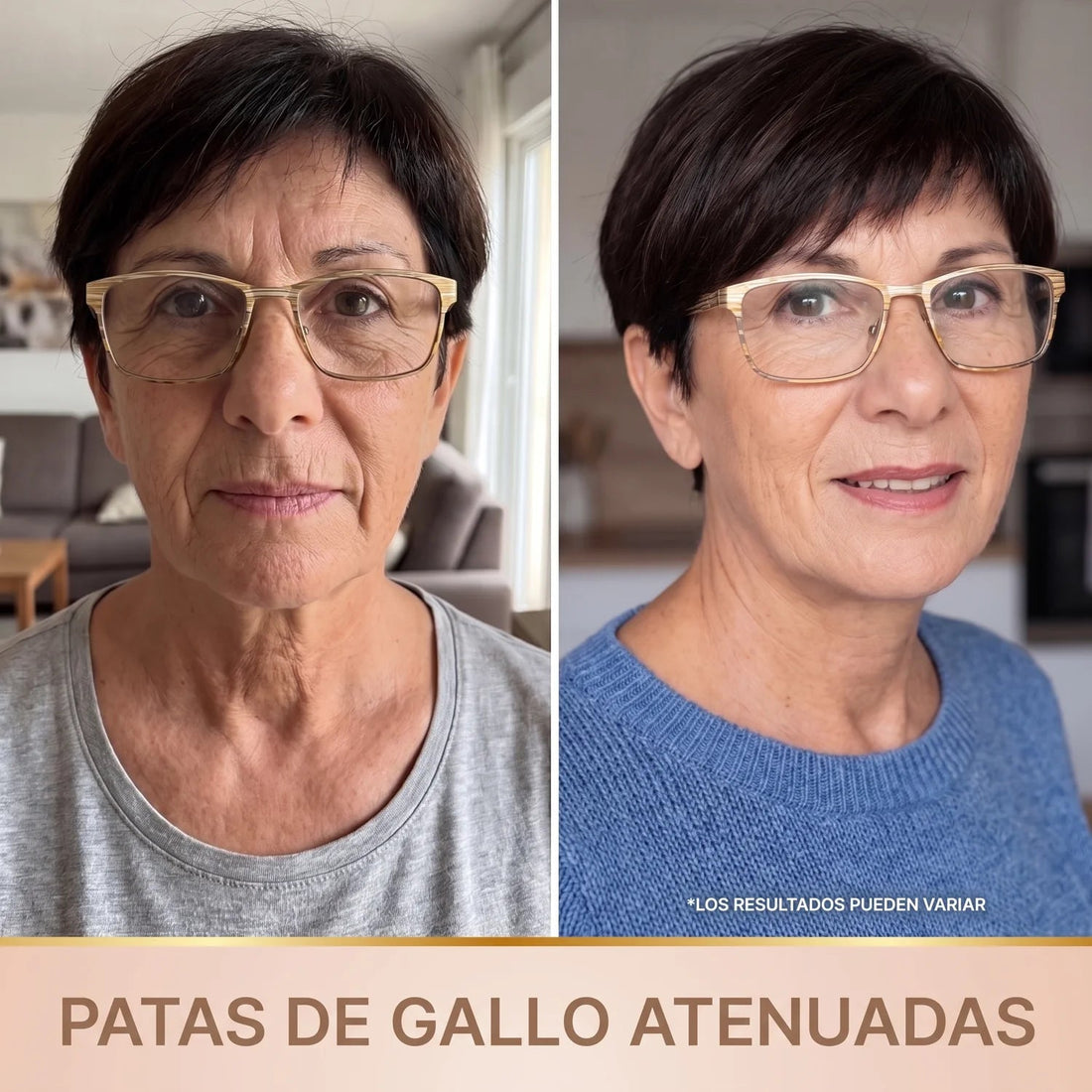 Patas de gallo