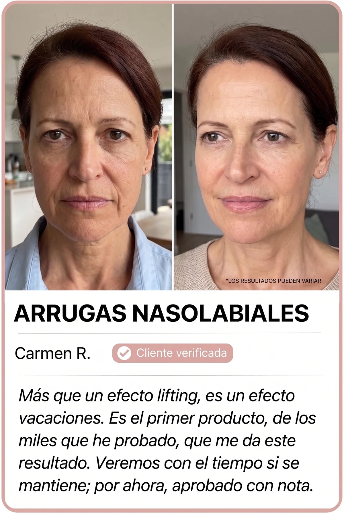 Transformación de clienta Nesolia 1