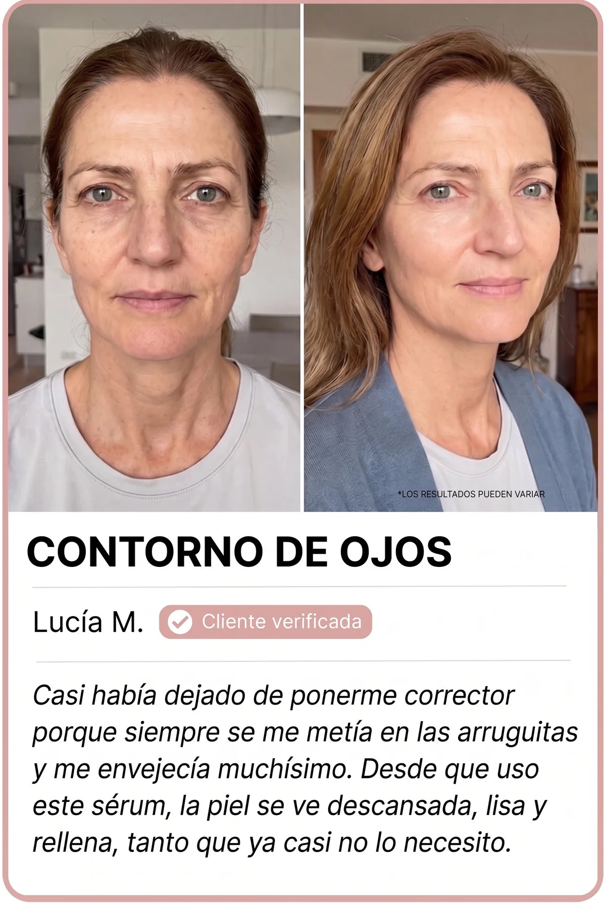 Transformación de clienta Nesolia 2