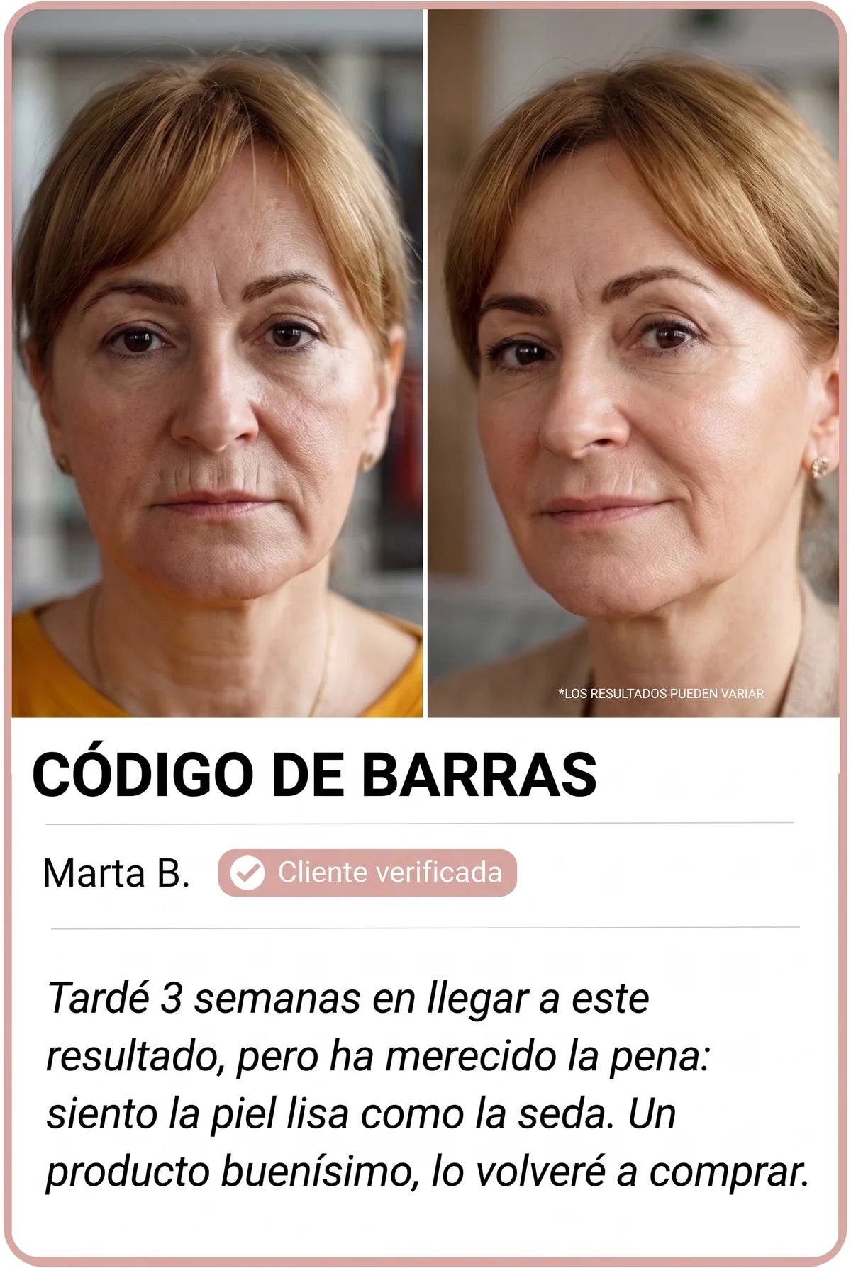 Transformación de clienta Nesolia 4